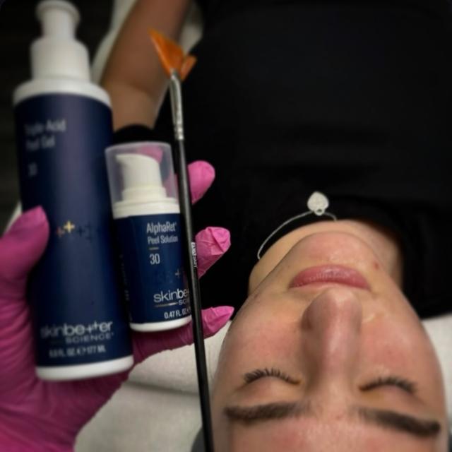 Skinbetter AlphaRet Peel